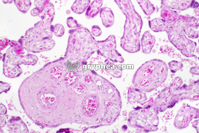 Placenta humain x40 - gryphea.org